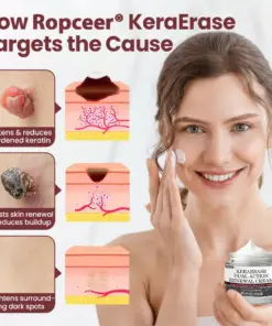 𝐑𝐨𝐩𝐜𝐞𝐞𝐫® 𝐊era𝐄rase Dual-Action Renewal Cream