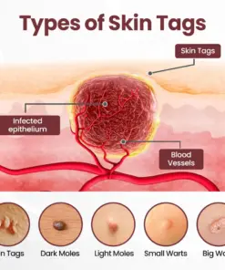 ๐๐จ๐ฉ๐๐๐๐ซยฎ ๐era๐rase Dual-Action Renewal Cream