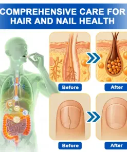 Ropceerยฎ ๐๐ก๐๐ ๐ถ๐๐๐ & ๐ถ๐๐๐๐๐๐๐ ๐๐๐๐ก๐๐๐ Anti-Sagging Oral Tablets