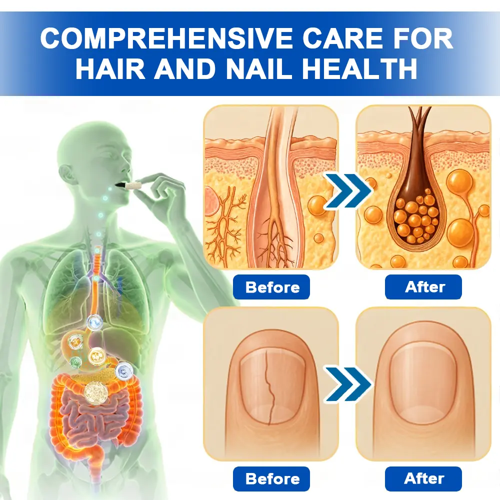 Ropceerยฎ ๐๐ก๐๐ ๐ถ๐๐๐ & ๐ถ๐๐๐๐๐๐๐ ๐๐๐๐ก๐๐๐ Anti-Sagging Oral Tablets