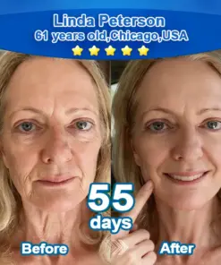 Ropceer® 𝑆𝑡𝑒𝑚 𝐶𝑒𝑙𝑙 & 𝐶𝑜𝑙𝑙𝑎𝑔𝑒𝑛 𝑃𝑒𝑝𝑡𝑖𝑑𝑒 Anti-Sagging Oral Tablets