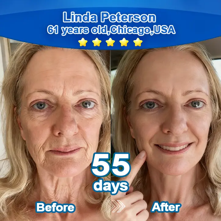 Ropceerยฎ ๐๐ก๐๐ ๐ถ๐๐๐ & ๐ถ๐๐๐๐๐๐๐ ๐๐๐๐ก๐๐๐ Anti-Sagging Oral Tablets