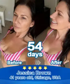 Ropceerยฎ ๐๐ก๐๐ ๐ถ๐๐๐ & ๐ถ๐๐๐๐๐๐๐ ๐๐๐๐ก๐๐๐ Anti-Sagging Oral Tablets