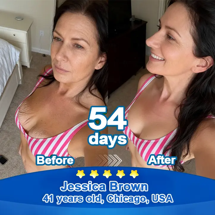 Ropceerยฎ ๐๐ก๐๐ ๐ถ๐๐๐ & ๐ถ๐๐๐๐๐๐๐ ๐๐๐๐ก๐๐๐ Anti-Sagging Oral Tablets