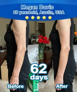 Ropceerยฎ ๐๐ก๐๐ ๐ถ๐๐๐ & ๐ถ๐๐๐๐๐๐๐ ๐๐๐๐ก๐๐๐ Anti-Sagging Oral Tablets