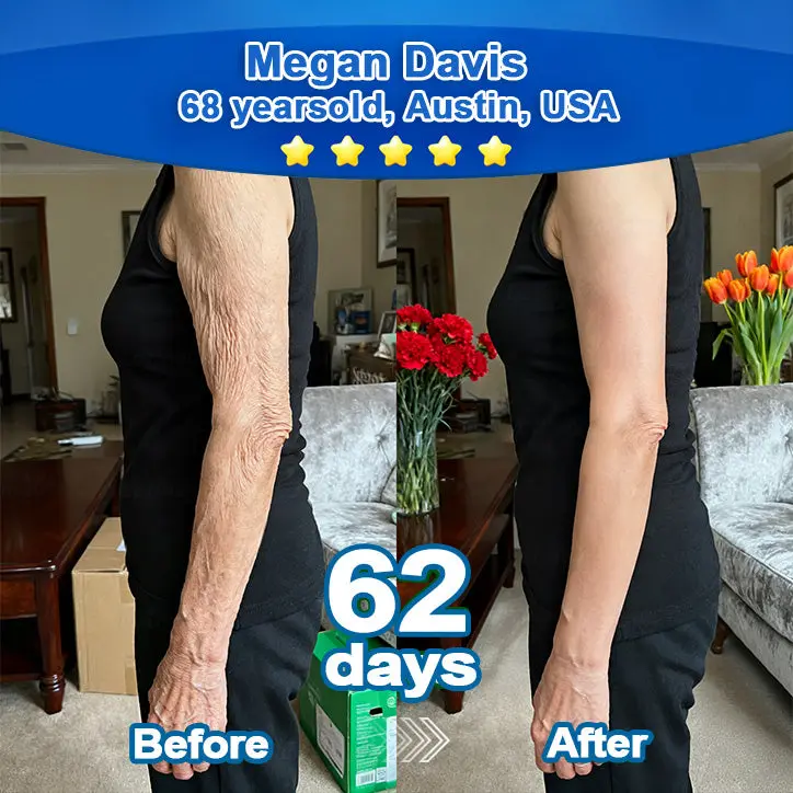 Ropceerยฎ ๐๐ก๐๐ ๐ถ๐๐๐ & ๐ถ๐๐๐๐๐๐๐ ๐๐๐๐ก๐๐๐ Anti-Sagging Oral Tablets