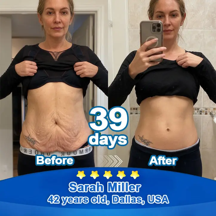 Ropceerยฎ ๐๐ก๐๐ ๐ถ๐๐๐ & ๐ถ๐๐๐๐๐๐๐ ๐๐๐๐ก๐๐๐ Anti-Sagging Oral Tablets