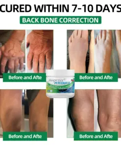 Ropceer® Powerful pain relief&recovery gel