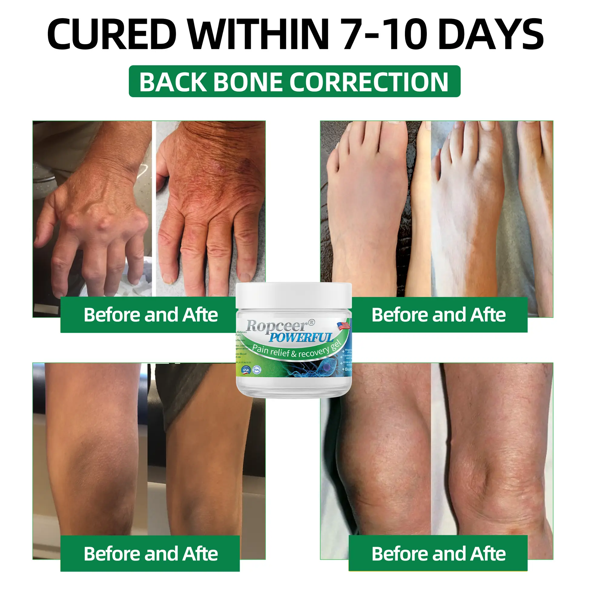 Ropceer® Powerful pain relief&recovery gel