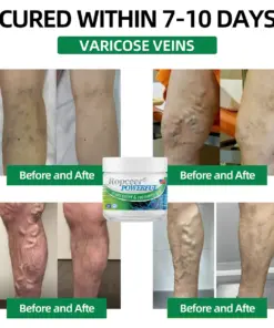 Ropceer® Powerful pain relief&recovery gel