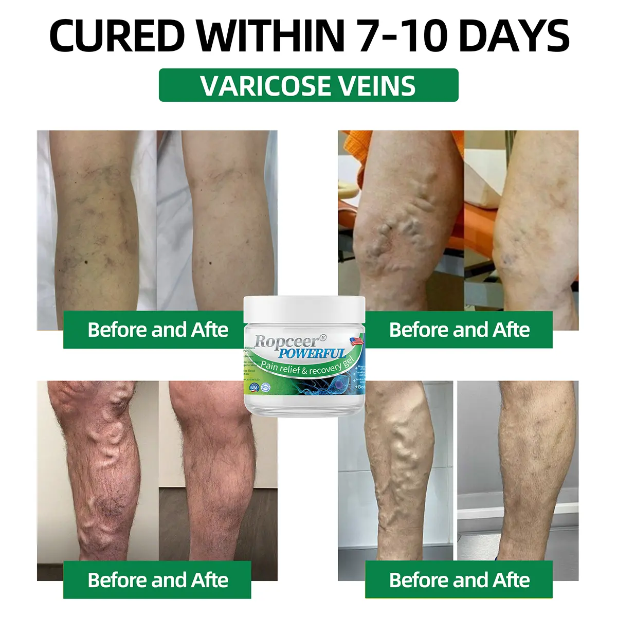 Ropceer® Powerful pain relief&recovery gel
