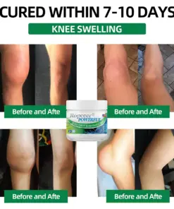 Ropceer® Powerful pain relief&recovery gel