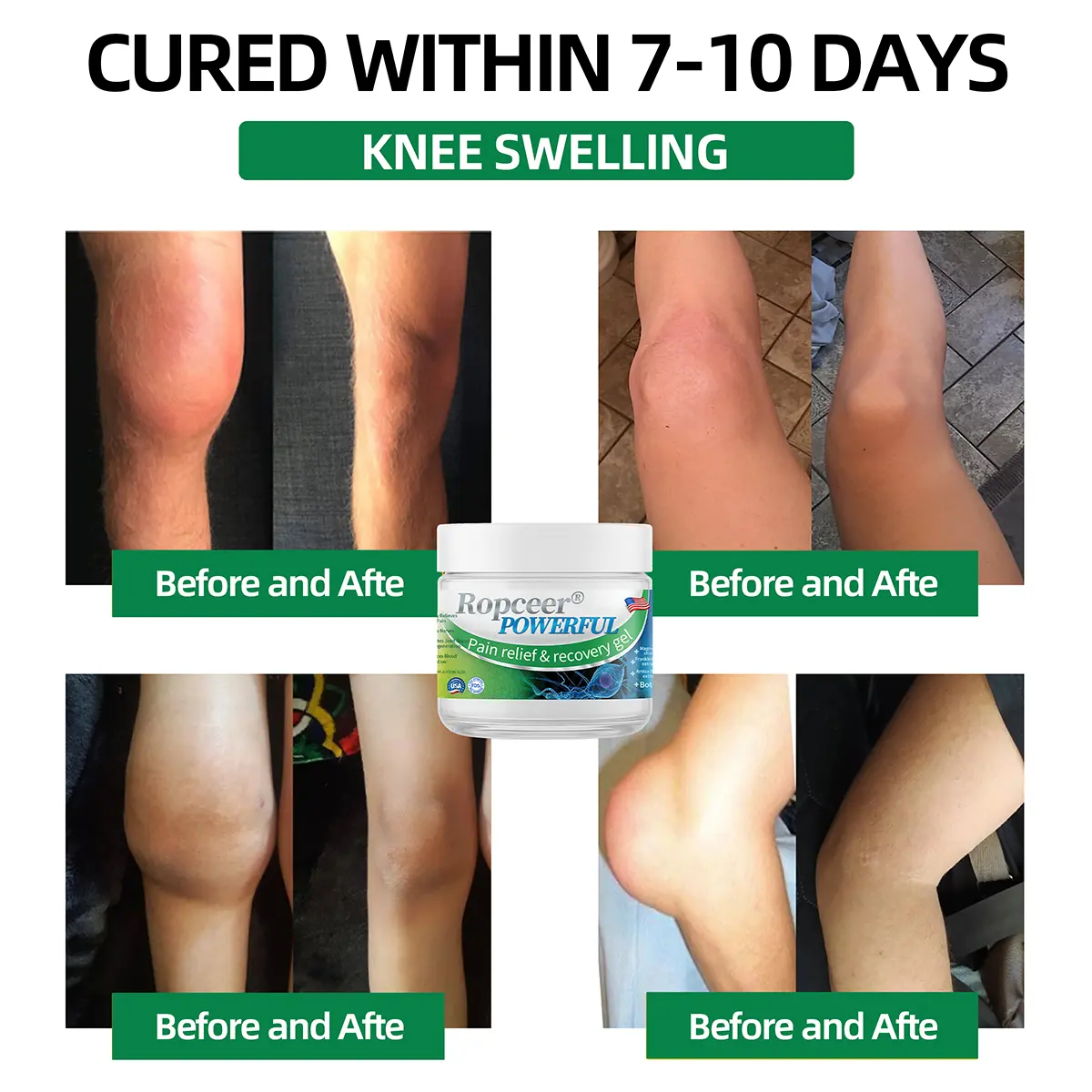 Ropceer® Powerful pain relief&recovery gel