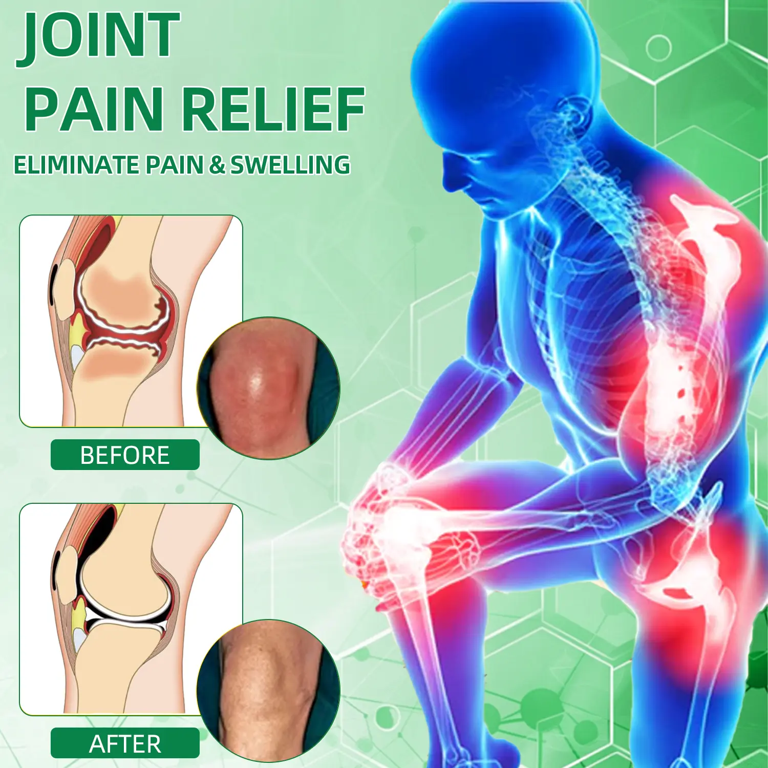Ropceer® Powerful pain relief&recovery gel